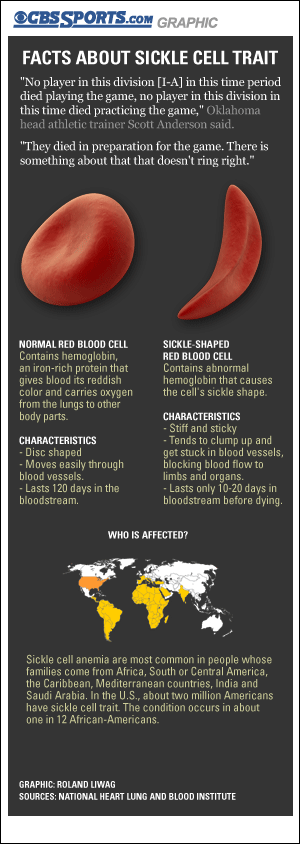 GRAPHIC: Facts about sickle cell trait